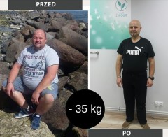 Grzegorz schudł 35 kg z Projekt Zdrowie
