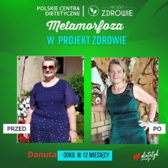 Niesamowita metamorfoza - Pani Danuta schudła 30 kg w Gabinecie Projekt Zdrowie!