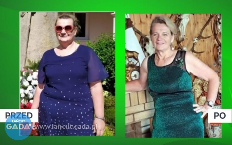 Niesamowita metamorfoza - Pani Danuta schudła 30 kg w Gabinecie Projekt Zdrowie!